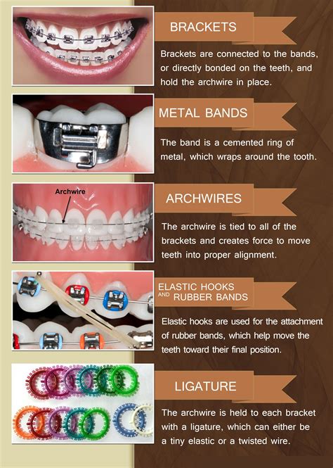 types of brackets in braces